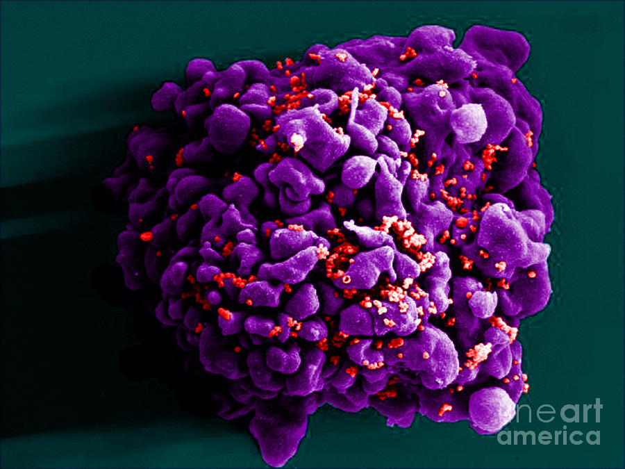 Hiv-infected H9 T Cell, Sem #5 Photograph by Science Source