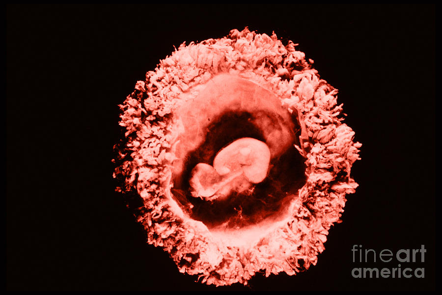 Human Embryo #5 Photograph by Omikron