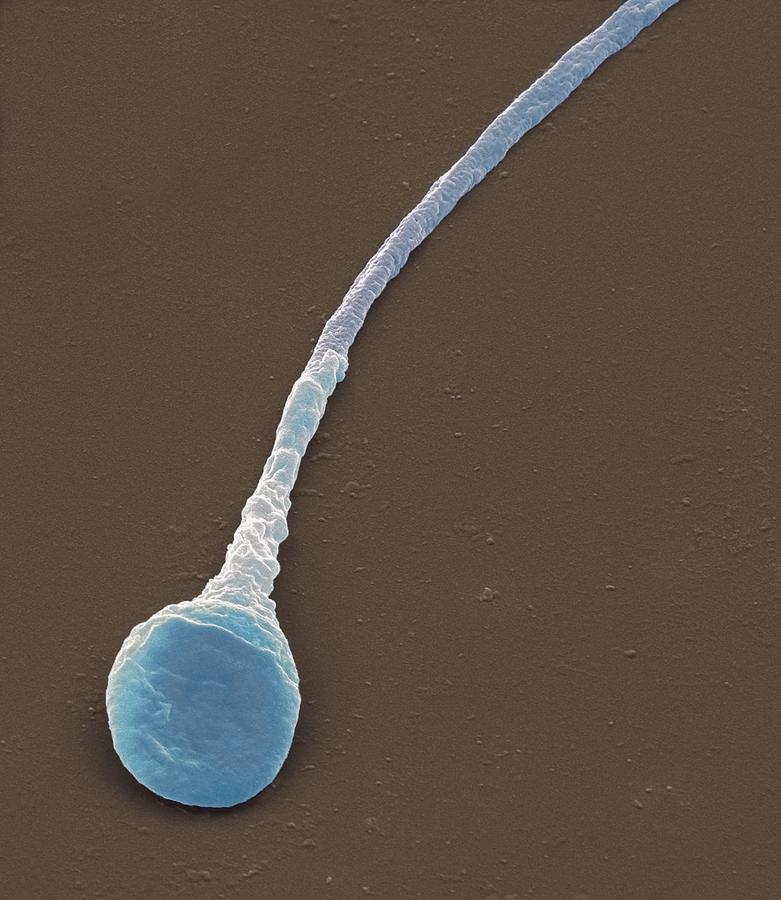 Human Sperm Cell Sem Photograph By Steve Gschmeissner 7760