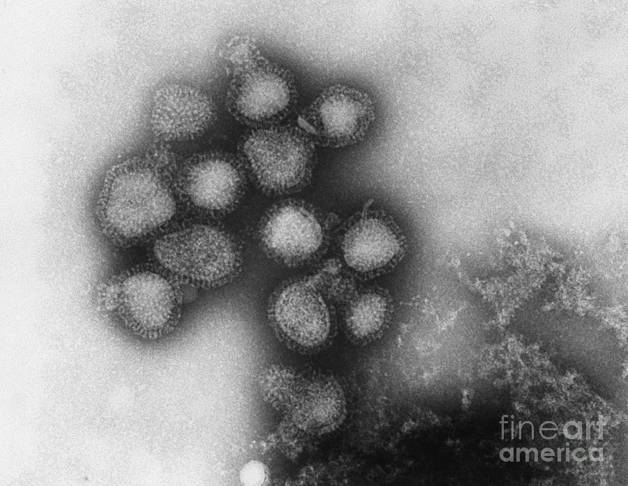 Influenza Virus #5 Photograph by Omikron