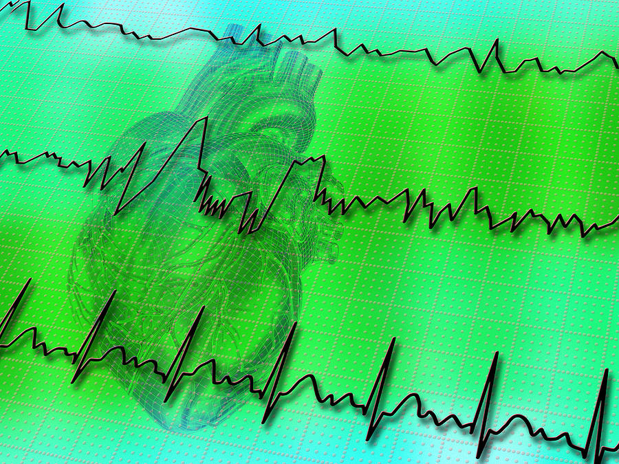 irregular-heartbeat-photograph-by-pasieka-fine-art-america