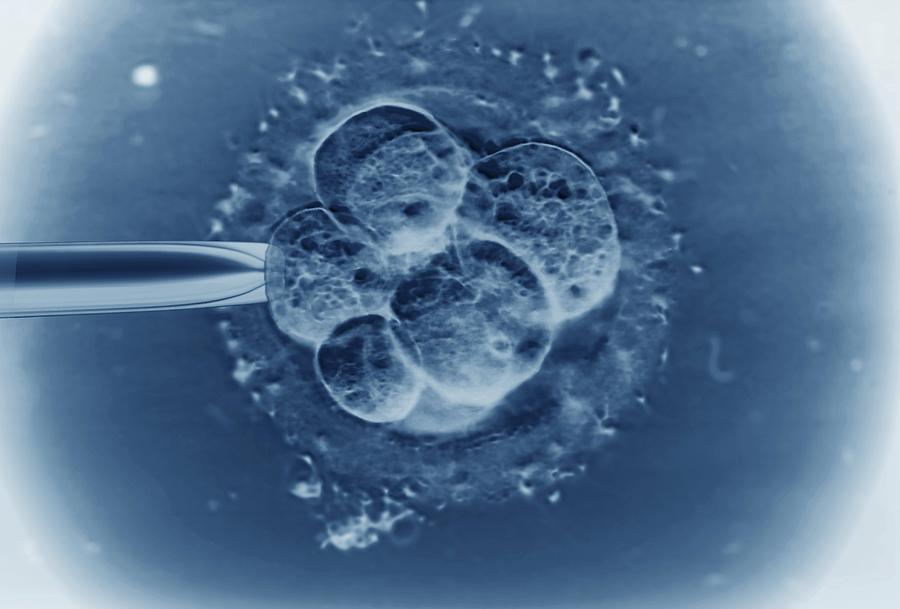 Human Photograph - Ivf Embryo, Light Micrograph #5 by Zephyr