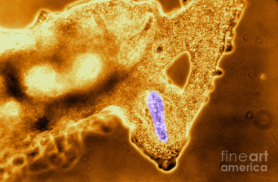 Light Micrograph Of Amoeba Catching #5 Photograph by Eric V. Grave