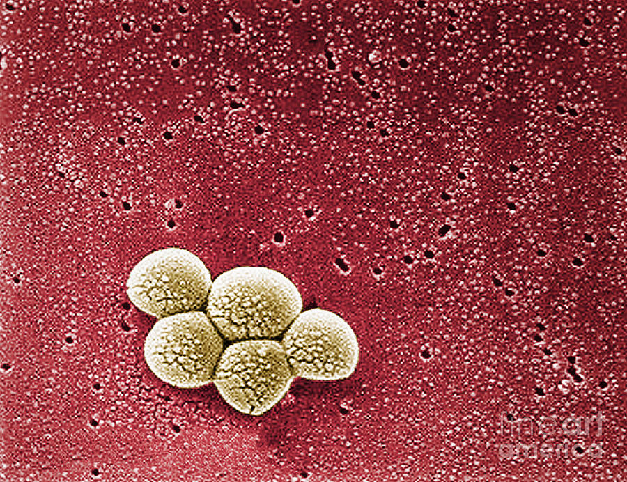 Methicillin-resistant Staphylococcus #5 Photograph by Science Source