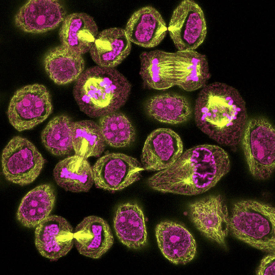 Mitosis, Light Micrograph Photograph by Dr Gopal Murti Biology Diagrams