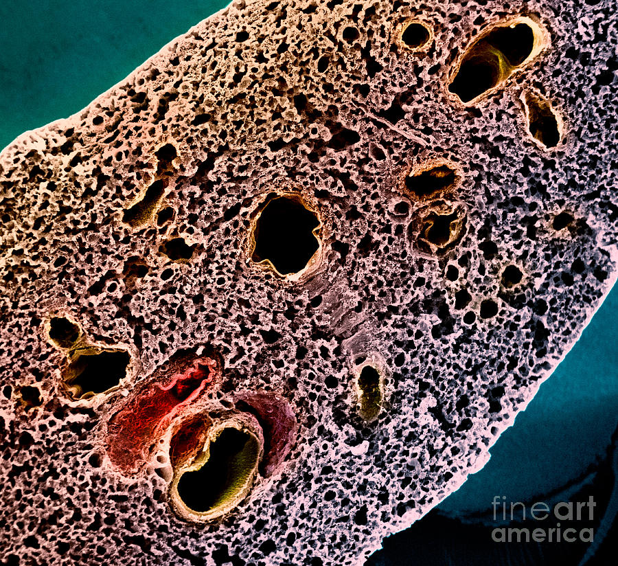 Mouse Lung, Sem #5 Photograph by Science Source