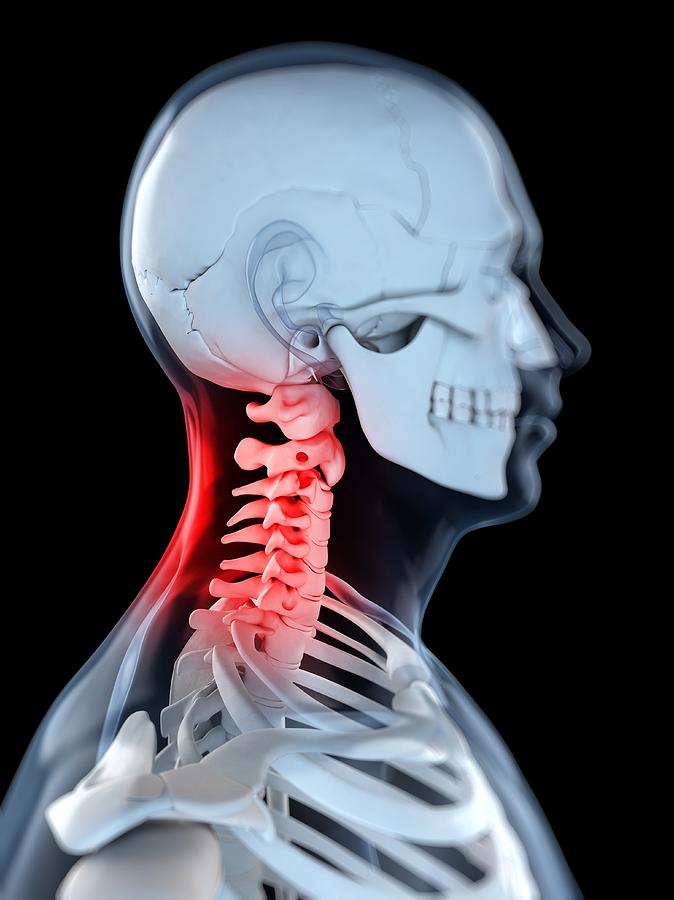 Neck Pain, Conceptual Artwork Digital Art by Sciepro - Fine Art America