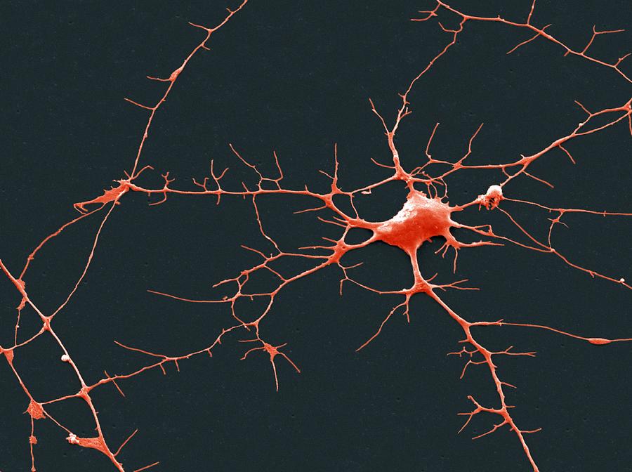 Клетка окружающая нейрон. Нейрон Пуанкаре микрофотография. Нервная клетки микротография. Аксон нейрона микрофотография. Отмирание нервных клеток.