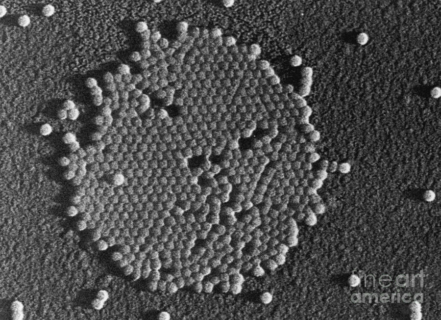 Polio Virus, Tem #5 Photograph by Omikron