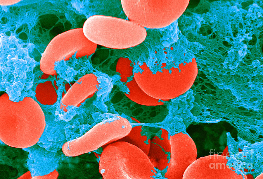 Red Blood Cells, Sem #16 Photograph by Science Source