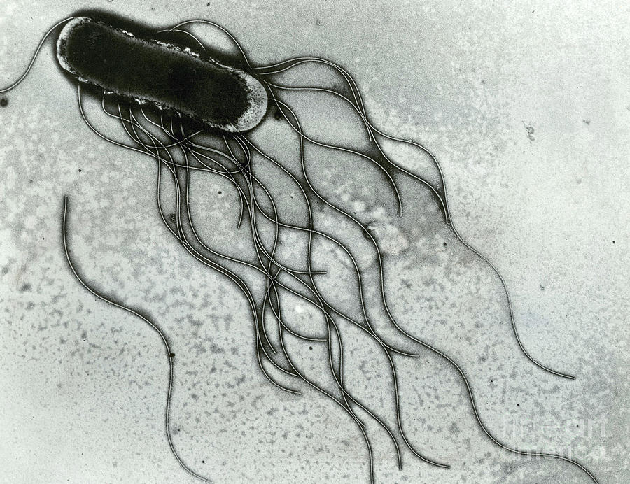 Salmonella #5 Photograph by Science Source