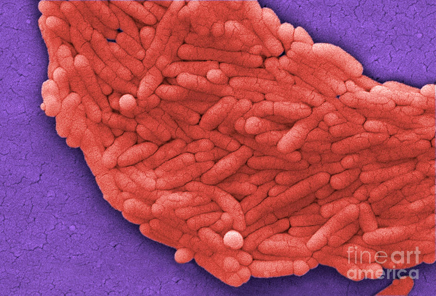 Salmonella, Sem #5 Photograph by Science Source