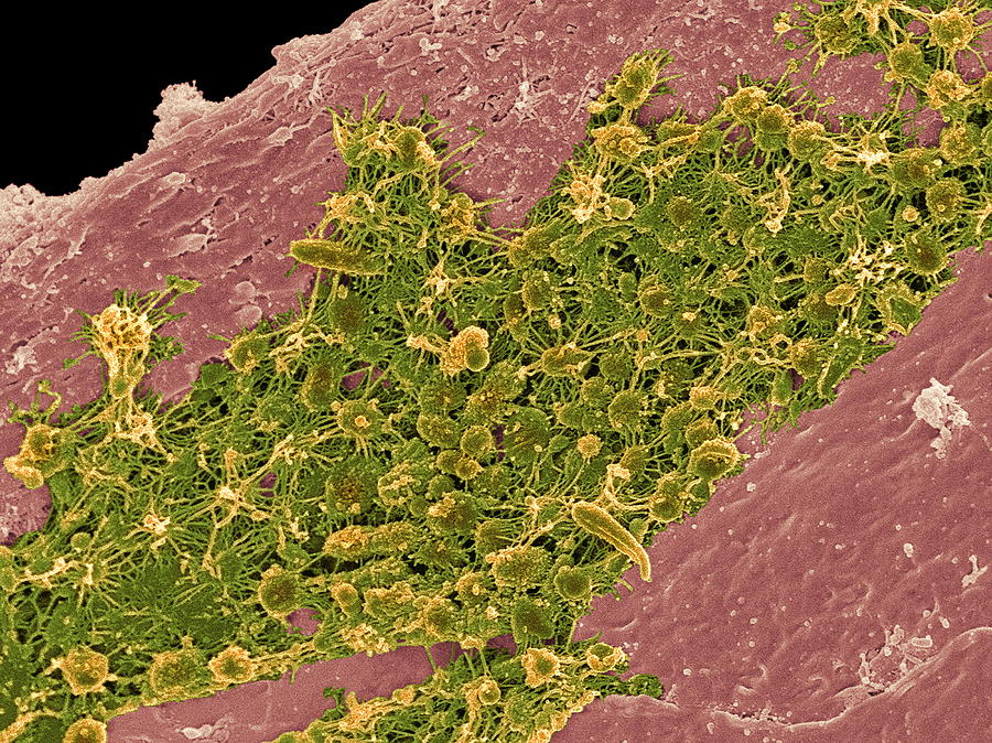 Micro-organisms Photograph - Tongue Bacteria, Sem #5 by Steve Gschmeissner