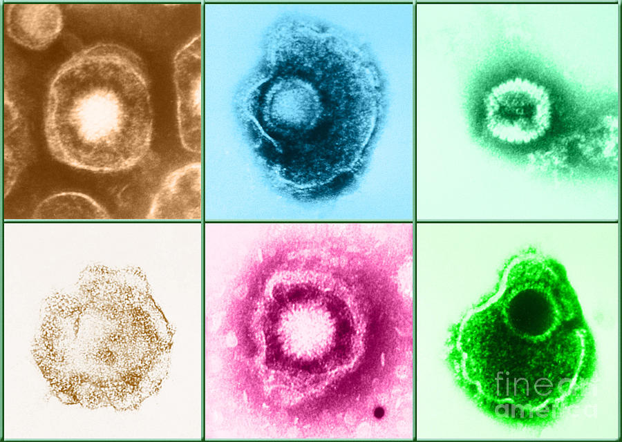 Various Forms Of Herpes Simplex Virus #9 Photograph by Science Source