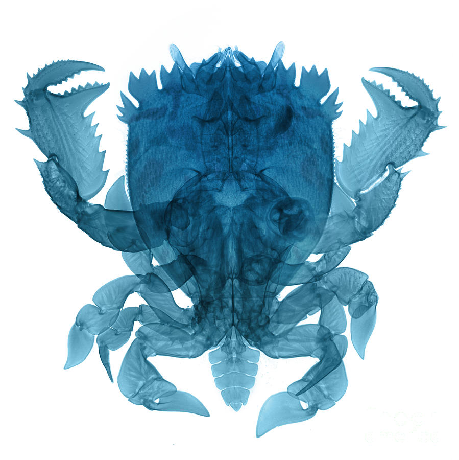 X-ray Of Deep Water Crab #8 Photograph by Ted Kinsman