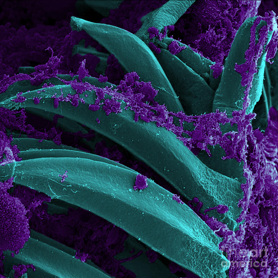 Microbiology Photograph - Yersinia Pestis Bacteria, Sem #5 by Science Source