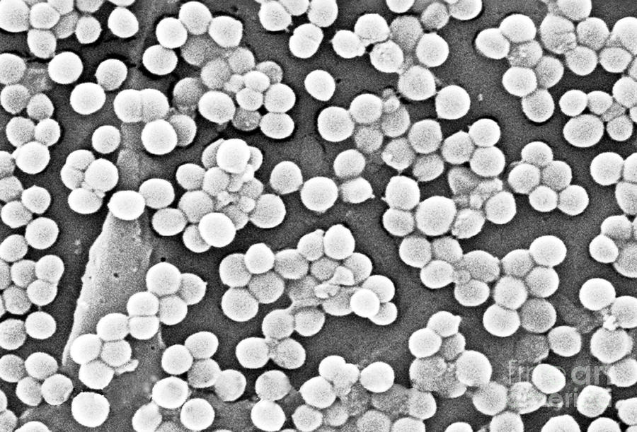 Methicillin-resistant Staphylococcus By Science Source - Pixels