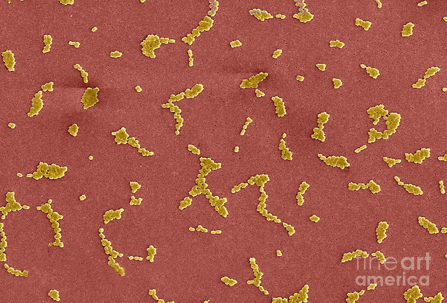 Acinetobacter Baumannii Bacteria, Sem #6 Photograph by Science Source
