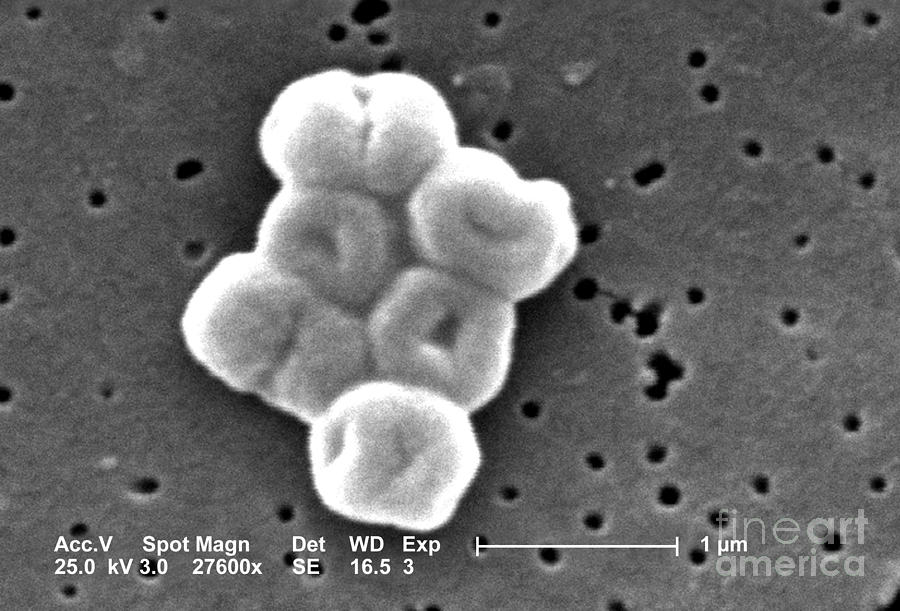 Acinetobacter Baumannii, Sem #6 Photograph by Science Source