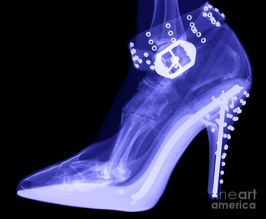 An Xray Of A Foot In A High Heel Shoe Photograph by Ted Kinsman Fine