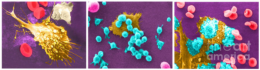 Cancer Cell Death Sequence, Sem #6 Photograph by Science Source