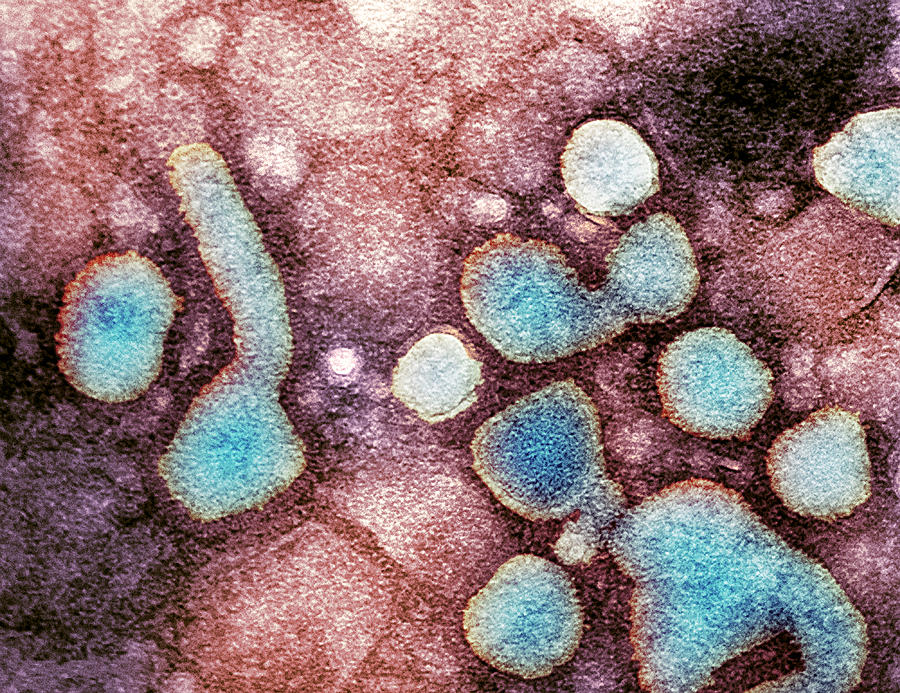 h5n1-avian-influenza-virus-particles-tem-photograph-by-nibsc-fine