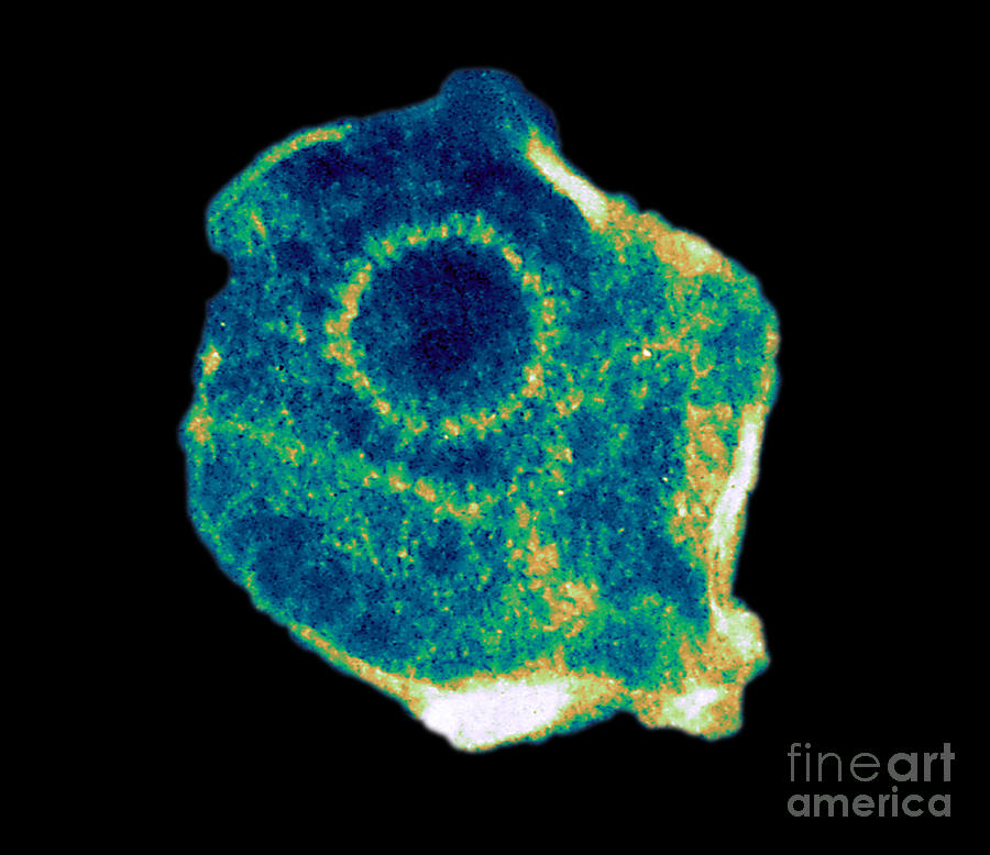 Herpes Simplex Virus Tem #6 Photograph by ASM/Science Source