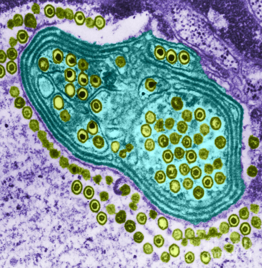 Herpes Simplex Virus, Tem #6 Photograph by Science Source