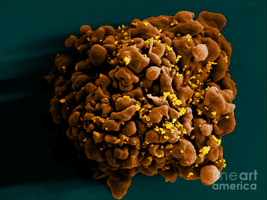 Hiv-infected H9 T Cell, Sem #6 Photograph by Science Source