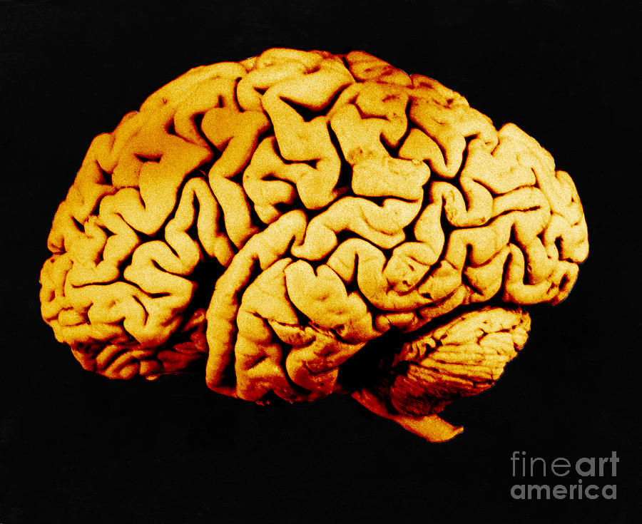 Human Brain #6 Photograph by Omikron