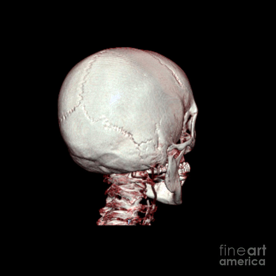 Skull Photograph - Human Skull #6 by Medical Body Scans