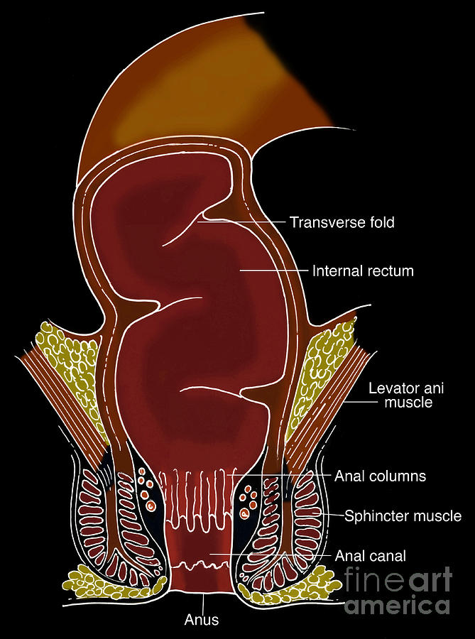 Illustration Of Rectum #6 Photograph by Science Source