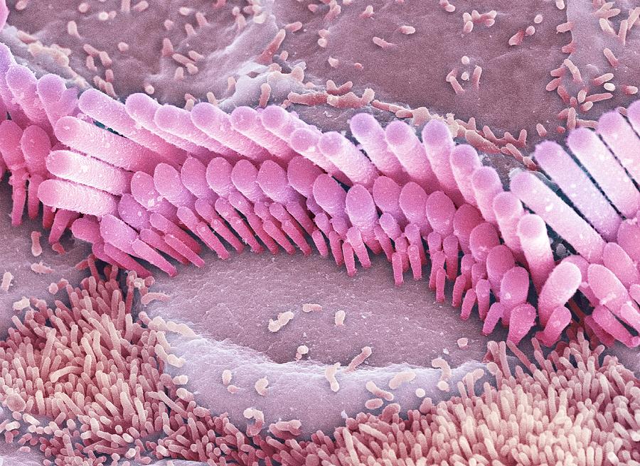 Inner Ear Hair Cells, Sem #6 Photograph by Dr David Furness, Keele University