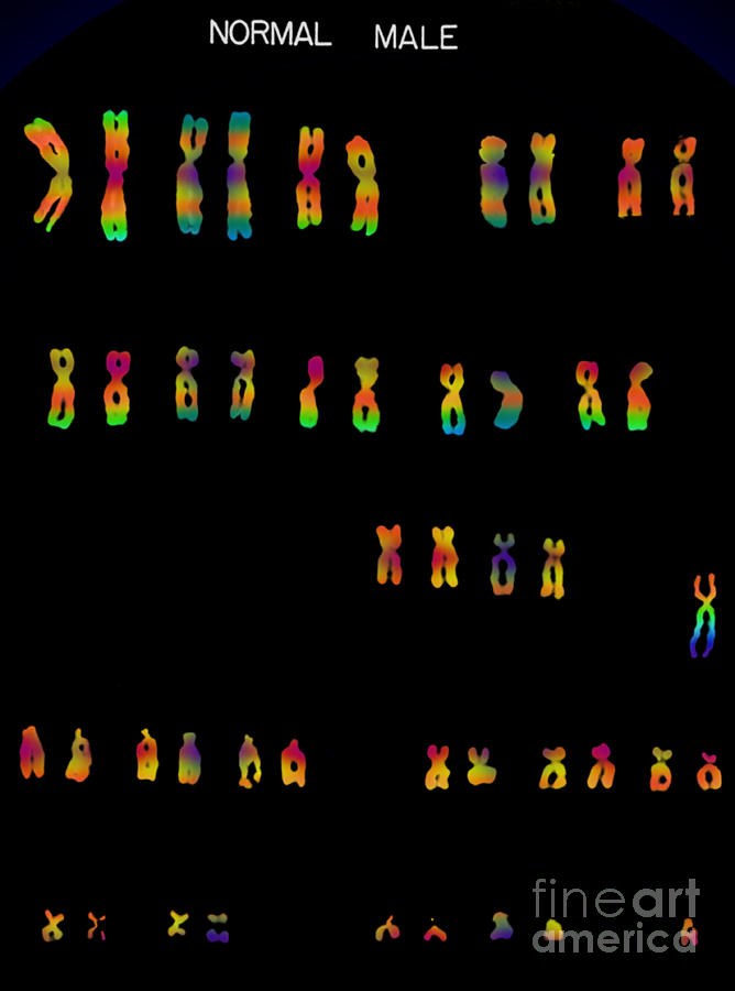Male Karyotype #6 Photograph by Omikron