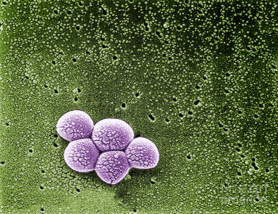 Methicillin-resistant Staphylococcus #6 Photograph By Science Source ...