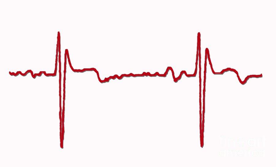 Normal Ecg #6 Photograph by Science Source
