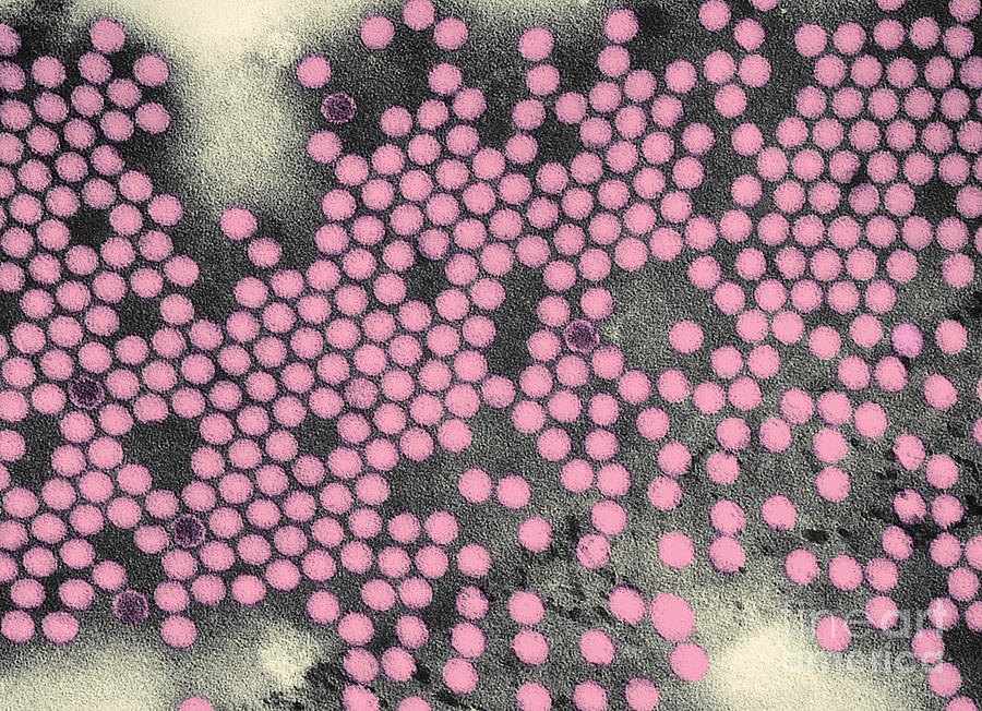 Poliovirus, Tem #6 Photograph by Science Source