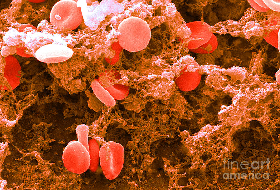 Red Blood Cells, Sem #6 Photograph by Science Source