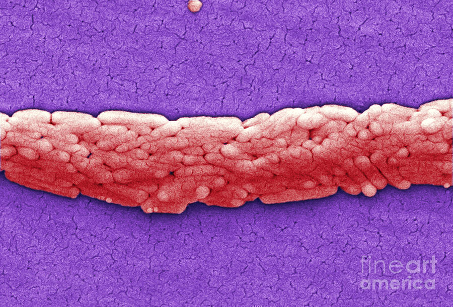 Salmonella, Sem #6 Photograph by Science Source