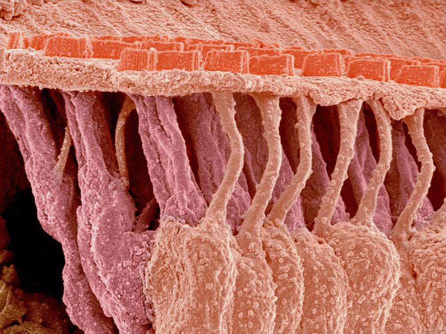 Sensory Hair Cells In Ear Sem Photograph By Susumu Nishinaga