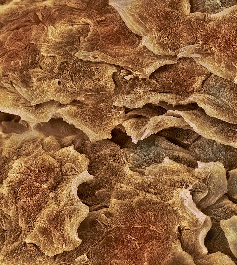 Skin Surface, Sem Photograph by Steve Gschmeissner