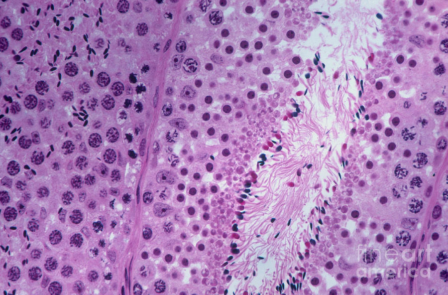 Testis Of A Monkey Lm #6 Photograph by M. I. Walker