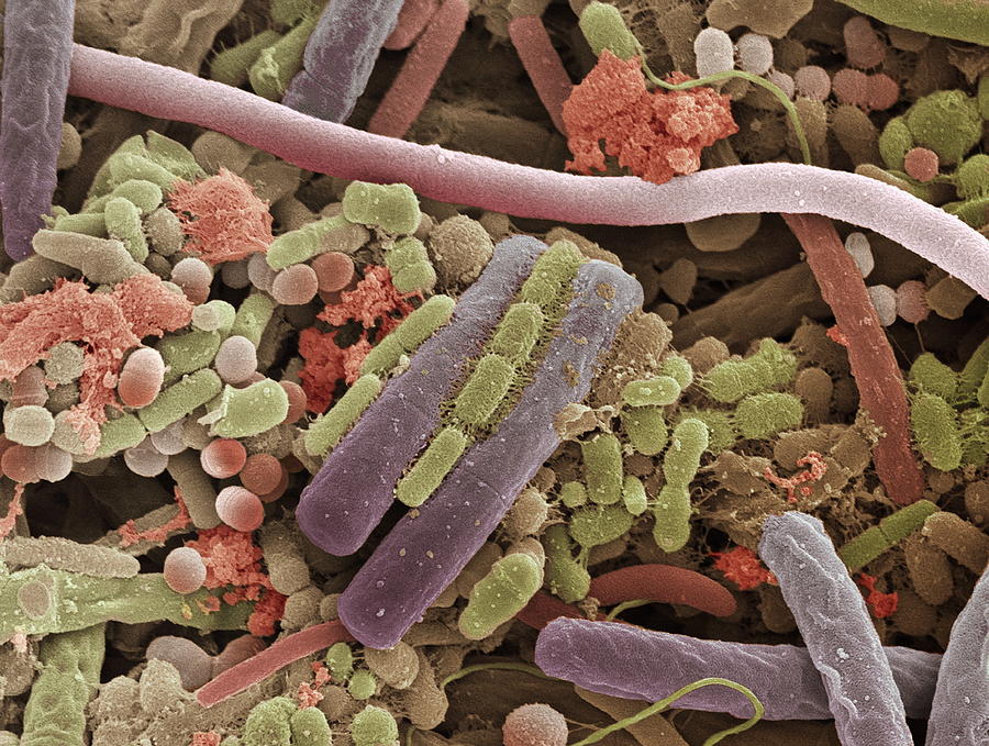 Micro-organisms Photograph - Tongue Bacteria, Sem #6 by Steve Gschmeissner