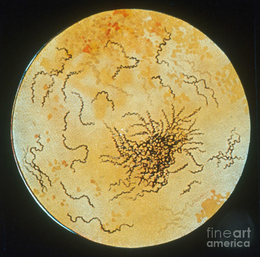Treponema Pallidum #6 Photograph by Science Source