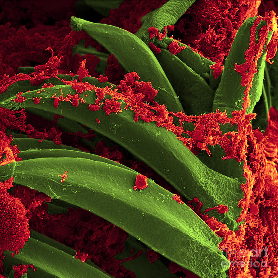 Yersinia Pestis Bacteria, Sem #6 Photograph by Science Source