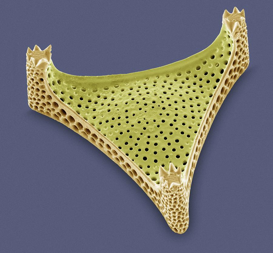 Nature Photograph - Diatom, Sem #62 by Steve Gschmeissner