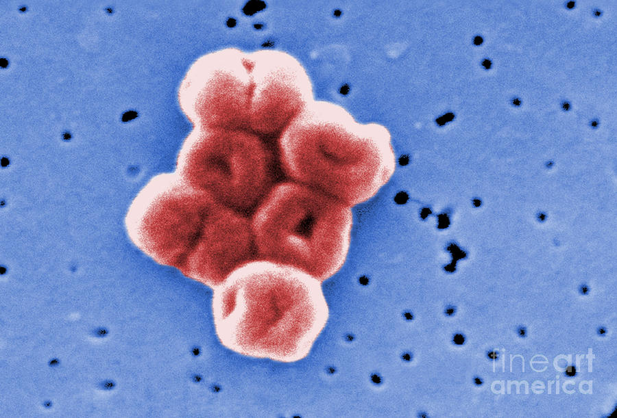 Acinetobacter Baumannii, Sem #7 Photograph by Science Source
