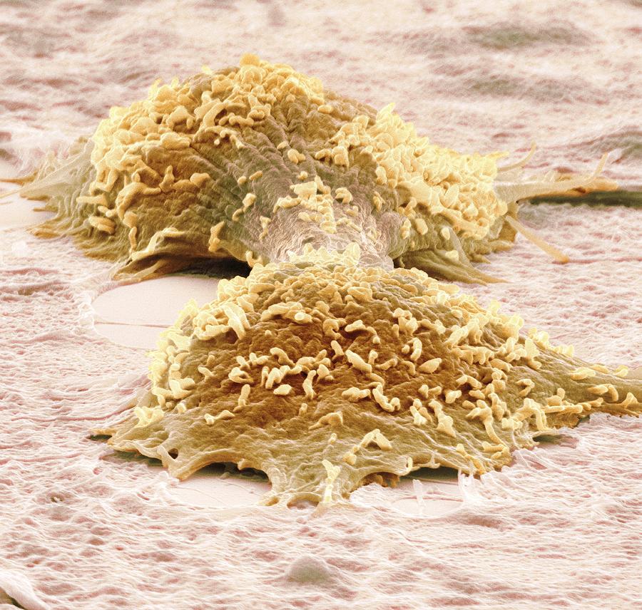 Biological Photograph - Dividing Cancer Cells, Sem #7 by Steve Gschmeissner