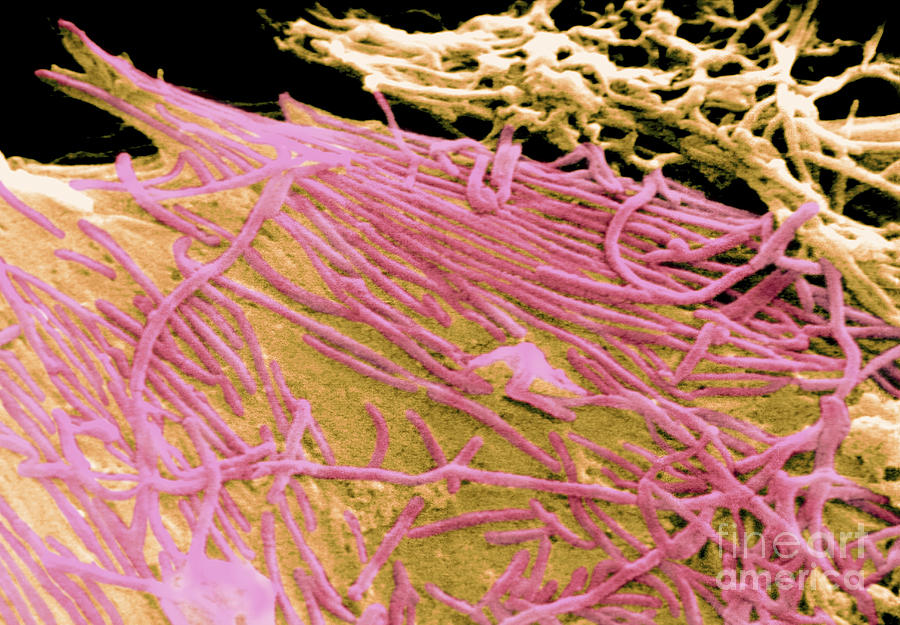 Ebola Virus, Sem #13 Photograph by Science Source