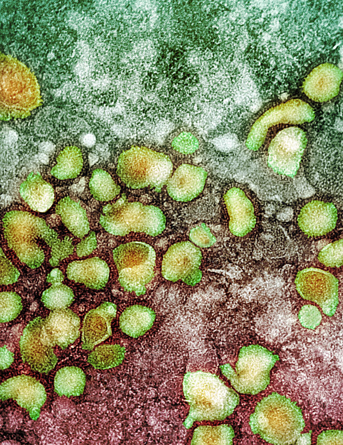 H5n1 Avian Influenza Virus Particles, Tem Photograph By Nibsc - Pixels